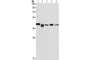 Gel: 10 % SDS-PAGE, Lysate: 40 μg, Lane 1-5: HepG2 cells, mouse kidney tissue, lovo cells, mouse eyes tissue, hela cells, Primary antibody: ABIN7129804(IDH3B Antibody) at dilution 1/233. (IDH3B antibody)