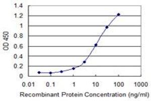 Detection limit for recombinant GST tagged SCML2 is 0. (SCML2 antibody  (AA 251-350))