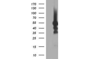 Image no. 1 for anti-Tubulin, beta 1 (TUBB1) antibody (ABIN1501569) (TUBB1 antibody)