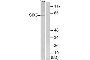 Western blot analysis of extracts from K562 cells, using SIX5 antibody. (Six5 antibody  (Internal Region))