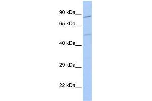WB Suggested Anti-ZNF585B Antibody Titration:  0.