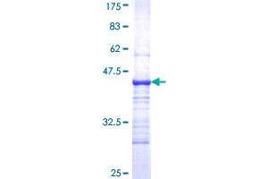 C4B Protein (AA 1347-1446) (GST tag)