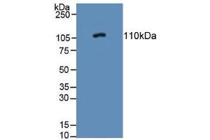 Western blot analysis of Rat Adrenal Gland Tissue. (PTPRN antibody  (AA 368-575))
