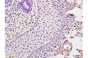 Formalin-fixed and paraffin embedded mouse embryo labeled with Anti ATAD5 Polyclonal Antibody,Unconjugated (ABIN872440) at 1:200 followed by conjugation to the secondary antibody and DAB staining. (ATAD5 antibody  (AA 1151-1250))