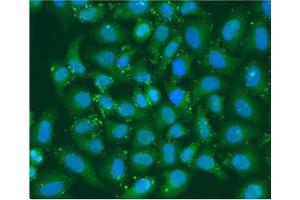 Immunofluorescence staining of U2OS cells with ABIN7141844 at 1:100, counter-stained with DAPI. (XBP1 antibody  (AA 1-261))