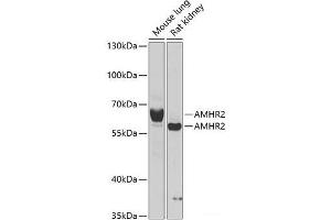 Western blot analysis of extracts of various cell lines using AMHR2 Polyclonal Antibody at dilution of 1:1000. (AMHR2 antibody)