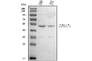 Western blot analysis of LPGAT1 using anti-LPGAT1 antibody (ABIN7601305).