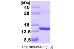 SDS-PAGE (SDS) image for Tubulin Folding Cofactor A (TBCA) (AA 1-108) protein (ABIN667113) (TBCA Protein (AA 1-108))