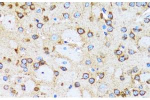 Immunohistochemistry of paraffin-embedded Rat brain using ACTR2 Polyclonal Antibody at dilution of 1:100 (40x lens).