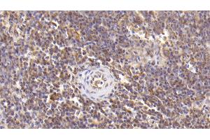 Detection of IL6 in Human Spleen Tissue using Monoclonal Antibody to Interleukin 6 (IL6) (IL-6 antibody  (AA 30-212))