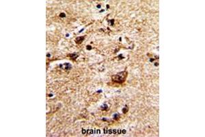 Immunohistochemistry (Paraffin-embedded Sections) (IHC (p)) image for anti-Adrenergic, alpha-1B-, Receptor (ADRA1B) (AA 276-306), (Middle Region) antibody (ABIN950364)