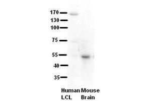 WB Suggested Anti-RRP1 Antibody Titration:  5% Milk  ELISA Titer:  dilution: 1:500  Positive Control:  human LCL and mouse brains (RRP1 antibody  (C-Term))