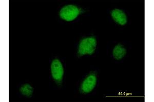 Immunofluorescence of purified MaxPab antibody to CPSF3 on HeLa cell. (CPSF3 antibody  (AA 1-684))
