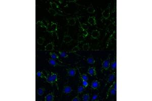 Immunofluorescence (IF) image for anti-Glutamate Dehydrogenase 1 (GLUD1) (AA 54-240) antibody (ABIN6141157)