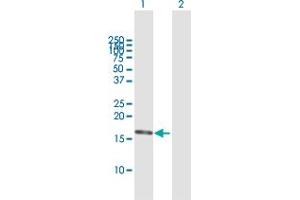 Western Blot analysis of DNPEP expression in transfected 293T cell line by DNPEP MaxPab polyclonal antibody. (Aspartyl Aminopeptidase antibody  (AA 1-164))