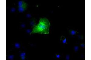 Image no. 4 for anti-Ring Finger Protein 144B (RNF144B) (AA 1-256) antibody (ABIN1490647)