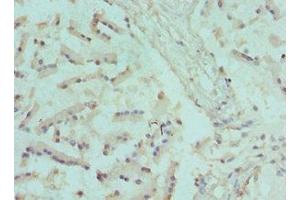 Immunohistochemistry of paraffin-embedded human prostate tissue using ABIN7170062 at dilution of 1:100 (CANT1 antibody  (AA 102-401))