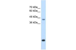 WB Suggested Anti-ASPN Antibody Titration:  2. (Asporin antibody  (Middle Region))