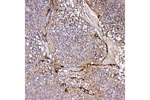 IHC analysis of IL1F10 using anti-IL1F10 antibody . (IL1F10 antibody  (AA 1-152))