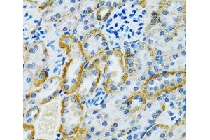 Immunohistochemistry of paraffin-embedded Rat kidney using GDAP1 Polyclonal Antibody at dilution of 1:100 (40x lens). (GDAP1 antibody)