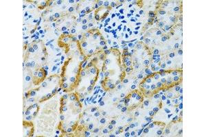 Immunohistochemistry of paraffin-embedded Rat kidney using GDAP1 Polyclonal Antibody at dilution of 1:100 (40x lens).