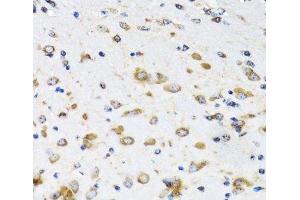 Immunohistochemistry of paraffin-embedded Mouse brain using COPB2 Polyclonal Antibody at dilution of 1:100 (40x lens). (COPB2 antibody)