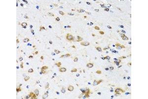 Immunohistochemistry of paraffin-embedded Mouse brain using COPB2 Polyclonal Antibody at dilution of 1:100 (40x lens).