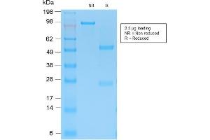 SDS-PAGE Analysis Purified Cytokeratin 15 Rabbit Recombinant Monoclonal Ab (KRT15/2103R). (Recombinant KRT15 antibody)