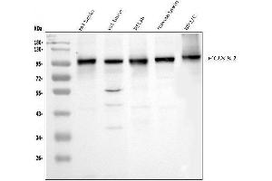 Western blot analysis of FOXK1 using anti-FOXK1 antibody (ABIN7600295). (Foxk1 antibody  (AA 175-671))
