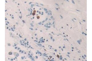 Used in DAB staining on fromalin fixed paraffin- embedded kidney tissue (KIR2DL3 antibody  (AA 22-342))