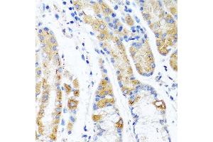 Immunohistochemistry of paraffin-embedded human stomach using CST1 antibody at dilution of 1:100 (40x lens). (CST1 antibody)