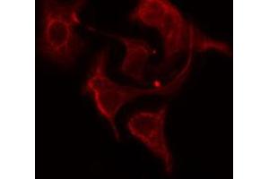 ABIN6274768 staining HepG2 cells by IF/ICC. (RPL12 antibody  (C-Term))