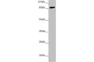 Western blot All lanes: CCHCR1 antibody at 2. (CCHCR1 antibody  (AA 483-782))