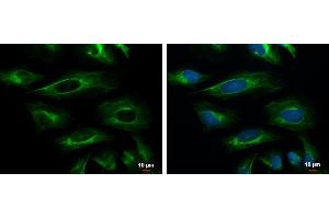 ICC/IF Image Cytokeratin 18 antibody [N2C2], Internal detects Cytokeratin 18 protein at cytoskeleton by immunofluorescent analysis. (Cytokeratin 18 antibody)