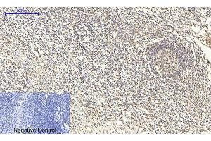 Immunohistochemical analysis of paraffin-embedded human tonsil tissue. (SMAD4 antibody  (AA 40-120))