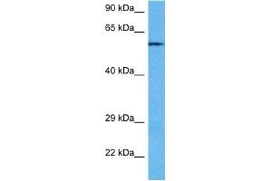 Host:  Rabbit  Target Name:  PPP3CA  Sample Tissue:  Mouse Heart  Antibody Dilution:  1ug/ml (PPP3CA antibody  (N-Term))