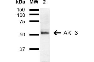 Western blot analysis of Mouse Brain showing detection of ~55 kDa AKT3 protein using Rabbit Anti-AKT3 Polyclonal Antibody (ABIN5667900). (AKT3 antibody  (AA 100-200) (PE))