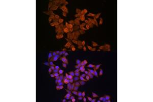 Immunofluorescence analysis of HeLa cells using S100 Rabbit pAb (ABIN6128693, ABIN6147339, ABIN6147340 and ABIN6214636) at dilution of 1:100 (40x lens). (S100A14 antibody  (AA 1-104))