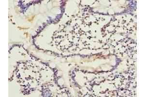Immunohistochemistry of paraffin-embedded human small intestine tissue using ABIN7143514 at dilution of 1:100 (ARL6IP1 antibody  (AA 93-133))
