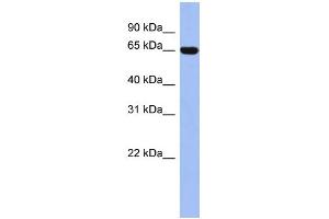 WB Suggested Anti-TRIM47 Antibody Titration:  0. (TRIM47 antibody  (Middle Region))