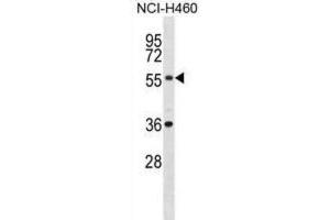Western Blotting (WB) image for anti-XK, Kell Blood Group Complex Subunit-Related, X-Linked (XKRX) antibody (ABIN2998986)