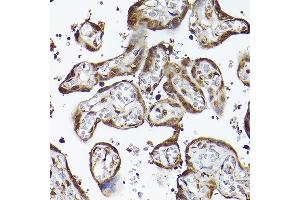 Immunohistochemistry of paraffin-embedded human placenta using UBQLN4 Rabbit pAb (ABIN7271124) at dilution of 1:150 (40x lens).