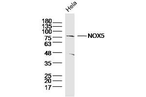 Hela lysates probed with NOX5 Polyclonal Antibody, Unconjugated  at 1:300 dilution and 4˚C overnight incubation. (NOX5 antibody  (AA 501-600))