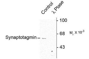 Image no. 1 for anti-Synaptotagmin I (SYT1) (pSer309) antibody (ABIN372725) (SYT1 antibody  (pSer309))