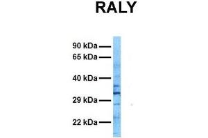 Host:  Rabbit  Target Name:  RALY  Sample Tissue:  Human Ovary Tumor  Antibody Dilution:  1. (Raly antibody  (N-Term))