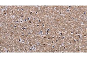 Immunohistochemistry of paraffin-embedded Human brain using MECP2 Polyclonal Antibody at dilution of 1:60 (MECP2 antibody)