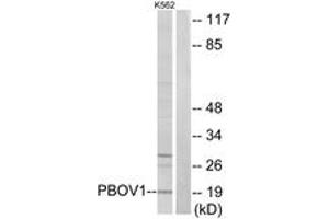 Western blot analysis of extracts from K562 cells, using PBOV1 Antibody. (PBOV1 antibody  (AA 31-80))