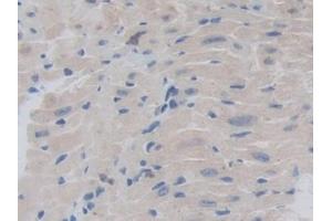 Immunohistochemistry (IHC) image for anti-Chordin (CHRD) (AA 422-635) antibody (ABIN7441952)