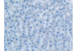 Detection of CEACAM1 in Rat Liver Tissue using Polyclonal Antibody to Carcinoembryonic Antigen Related Cell Adhesion Molecule 1 (CEACAM1)