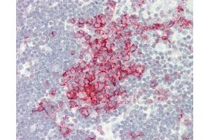 Immunohistochemistry (Paraffin-embedded Sections) (IHC (p)) image for anti-Membrane-Spanning 4-Domains, Subfamily A, Member 1 (MS4A1) antibody (FITC) (ABIN2592880)